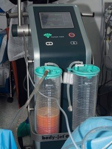 تقنية WAL في جراحة تقليل دهون الليبيديما